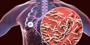 How an Ancient Disease Is Outsmarting Modern Medicine