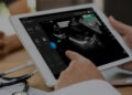 FDA Grants Clearance for UltraSight’s AI Cardiac Ultrasound