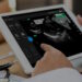 FDA Grants Clearance for UltraSight’s AI Cardiac Ultrasound