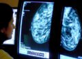 Health leaders welcome new UK cancer targets but warn more ‘resources’ needed