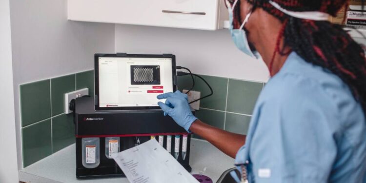 UK scientists develop 10-minute blood test to diagnose diseases