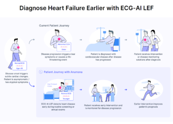 Anumana Receives FDA Clearance for ECG-AI Algorithm to Detect Low Ejection Fraction