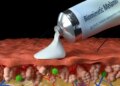 New “Super Melanin” Cream Heals Skin Injuries From Sunburn, Chemical Burns
