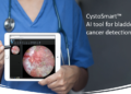 Intelligent Scopes and Mayo Clinic Partner to Develop AI-Powered Tools for Bladder Cancer