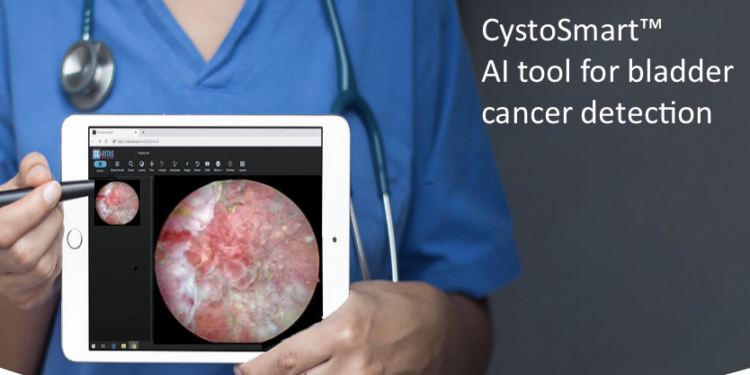 Intelligent Scopes and Mayo Clinic Partner to Develop AI-Powered Tools for Bladder Cancer
