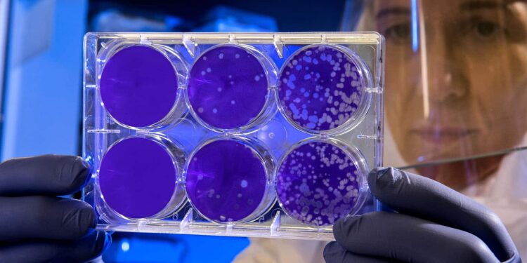 In addition to long COVID, there’s also long flu