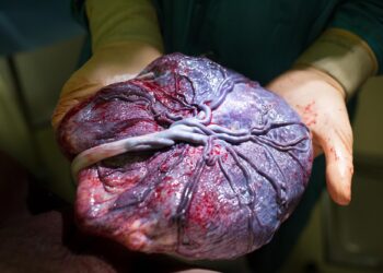 Shocking Study Finds Microplastics in Every Human Placenta