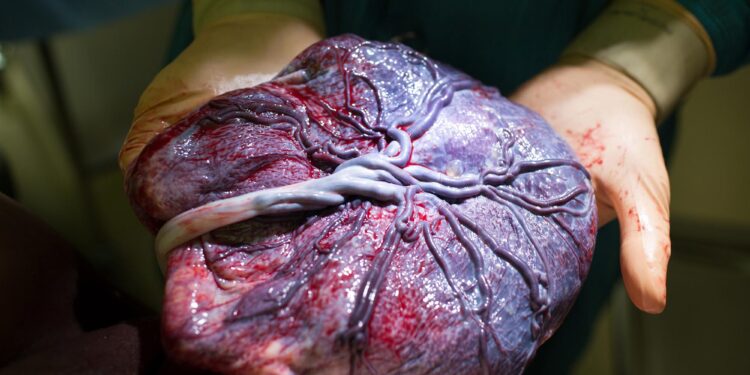 Shocking Study Finds Microplastics in Every Human Placenta