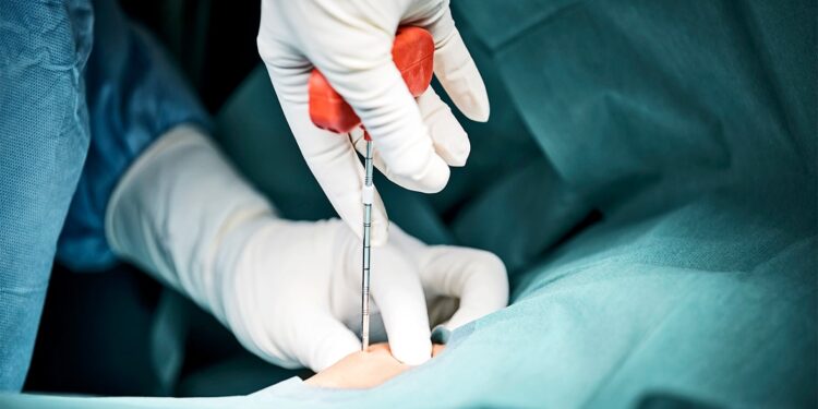 New treatments could tackle bone marrow transplant complications