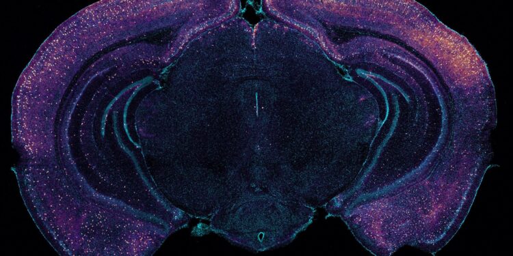 How 40 Hz Light and Sound Waves Could Halt Alzheimer’s