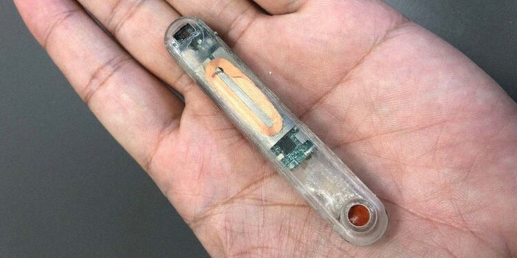 Implantable Device Can Detect and Reverse Opioid Overdose