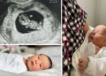 Disrupting IVF? Baby born from egg matured outside of mother’s body.