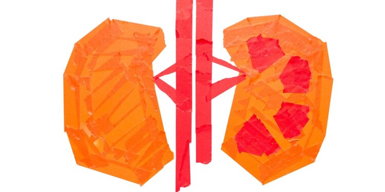 Kidney disease hampers immune response to the flu