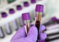 Breakthrough Blood Test Accurately Identifies ALS and Tracks Progression