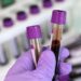 Breakthrough Blood Test Accurately Identifies ALS and Tracks Progression