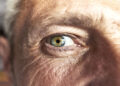 Eye changes may be early warning for Alzheimer’s