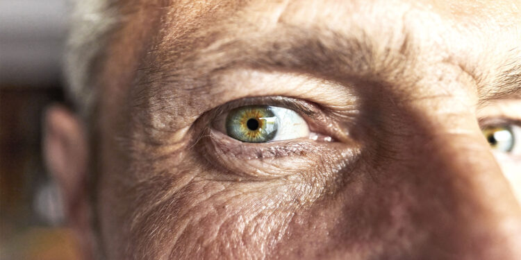 Eye changes may be early warning for Alzheimer’s