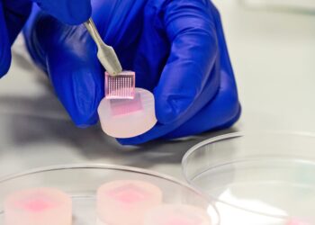 Microneedle patches could speed up diabetic wound healing