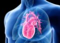New Study Reveals 56 Modifiable Risk Factors for Sudden Cardiac Arrest
