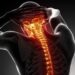 New Molecules Target Root Cause of Chronic Pain Without Opioids