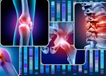 $486 Billion Problem: Groundbreaking Study Could Slash Osteoarthritis Costs