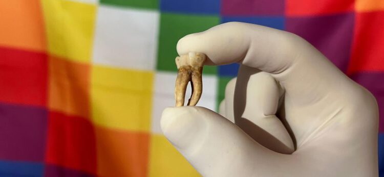 Ancient DNA Reveals Leprosy Was in America Centuries Before Columbus