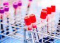 Blood tests can detect cancer 3 years before diagnosis