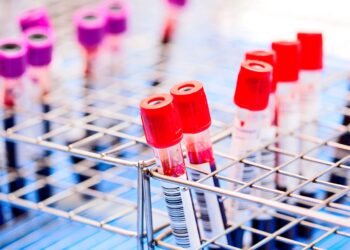 Blood tests can detect cancer 3 years before diagnosis