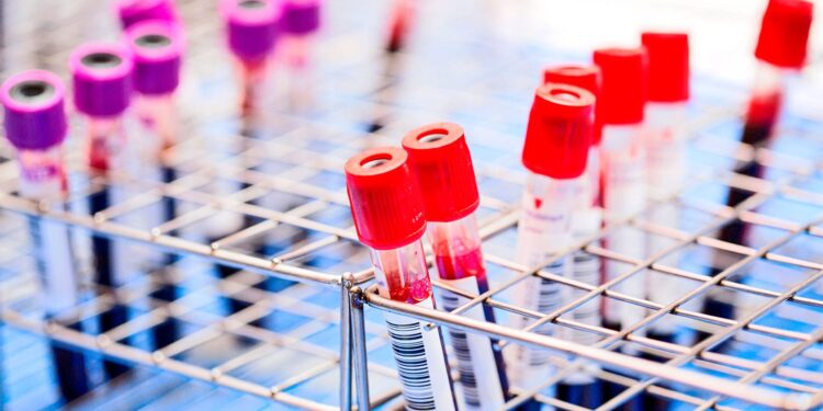 Blood tests can detect cancer 3 years before diagnosis