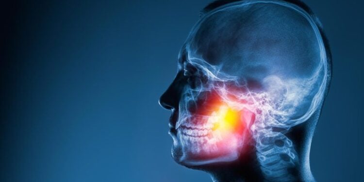 Doctors Warn: Popular Bone Medications May Cause Serious Jaw Disease