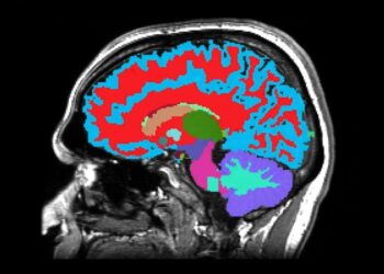 This MRI Reads Your Brain’s Hidden Clock and Predicts Dementia Decades Ahead