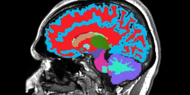 This MRI Reads Your Brain’s Hidden Clock and Predicts Dementia Decades Ahead