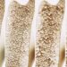 The Newly Found Bone Switch That Could Stop Osteoporosis