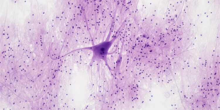 This Crawling Robot Is Made With Living Brain and Muscle Cells