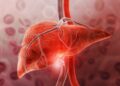 This Simple Test Can Predict Risk of Severe Liver Disease Up to 10 Years in Advance