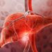 This Simple Test Can Predict Risk of Severe Liver Disease Up to 10 Years in Advance