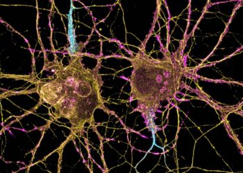 A New Approach Could Transform Huntington’s Disease Treatment