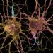 A New Approach Could Transform Huntington’s Disease Treatment