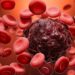 AI Blood Cell Analyzer Outperforms Human Experts in Detecting Leukemia