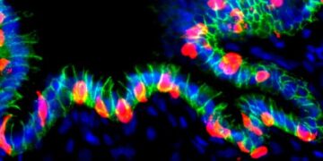 Scientists Just Turned Stomach Cells Into Insulin Producers to Treat Diabetes