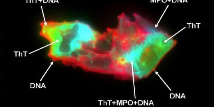 Scientists Uncover Hidden Blood Pattern in Long COVID