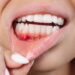 This Common Dental Problem Could Threaten Your Brain