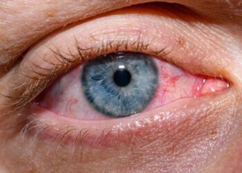 Scientists Grew Human Tear Glands to Solve a Painful Mystery