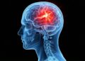 Researchers Discover Compound That Could Revolutionize Traumatic Brain Injury Treatment
