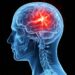Researchers Discover Compound That Could Revolutionize Traumatic Brain Injury Treatment