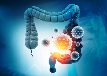 The Immune Chain Reaction That Raises Colon Cancer Risk in IBD