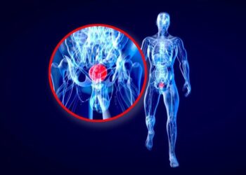 Stanford Study Reveals Colorblindness May Hide a Deadly Cancer Warning