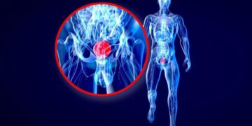 Stanford Study Reveals Colorblindness May Hide a Deadly Cancer Warning