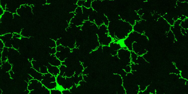 Refreshing the Brain’s Immune Cells Could Treat a Host of Diseases