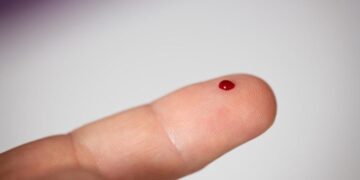 This New Blood Test Can Detect Cancer Before Tumors Appear